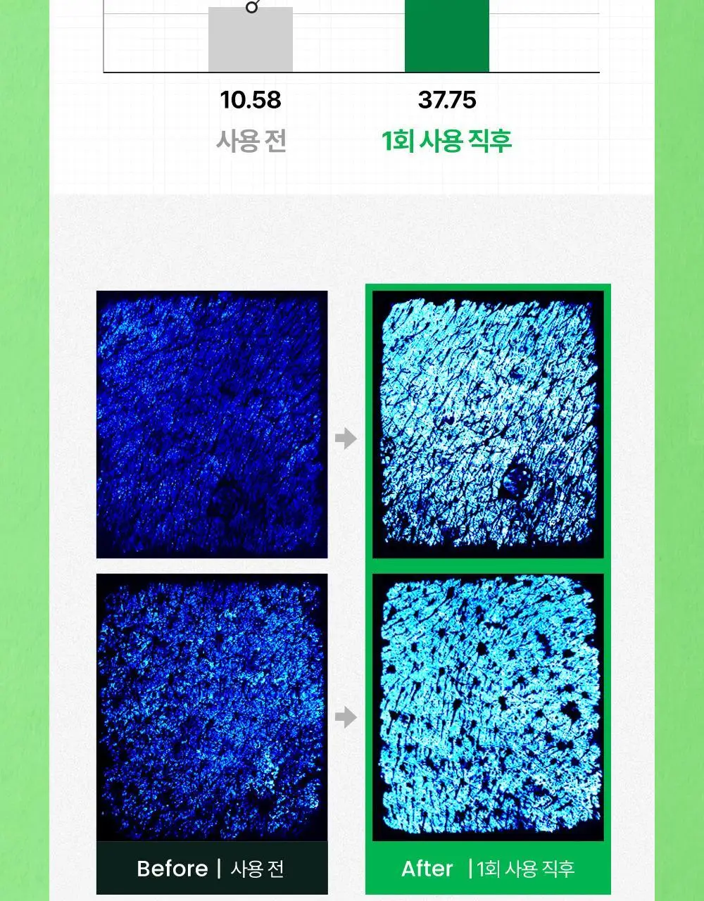 [화잘먹 엑소좀진정크림] 리브엠 시카좀 카밍 워터 젤크림 100ml 상세페이지 22
